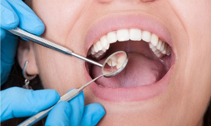 Лікування зубів: чому варто зробити відвідування стоматолога корисною звичкою